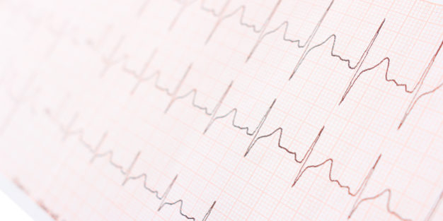 guidelines ECG HF stimulation Guidelines ECG HF Stimulation
