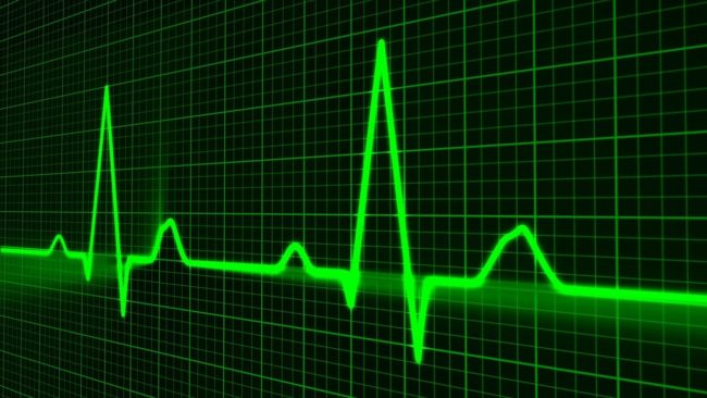 pulse-trace-163708_1280 EU MDR Technical Documentation